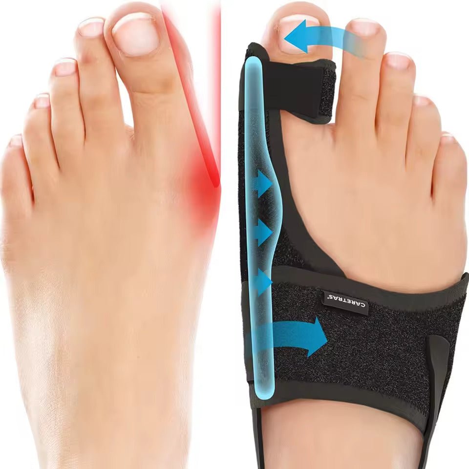 Szyna nocna na haluksy – ergonomiczna i regulowana